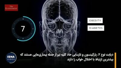 خواب نامنظم با بدن چه می‌کند؟