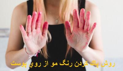 بهترین روش پاک کردن رنگ مو از روی پوست دست و صورت