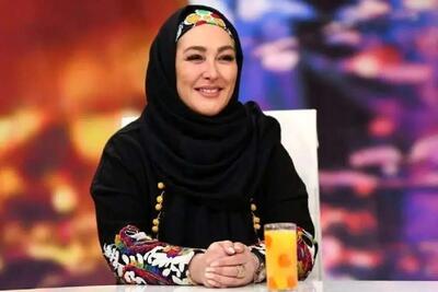 تصاویر باورنکردنی از چهره عملی الهام حمیدی که باورش سخته!