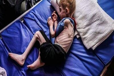 شمار شهدای گرسنگی در نوار غزه به ۲۵۱ نفر رسید