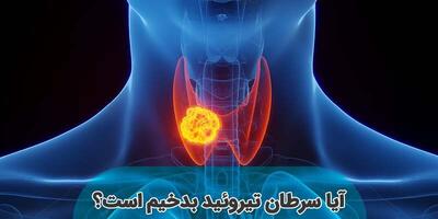 آیا سرطان تیروئید بدخیم کشنده است؟
