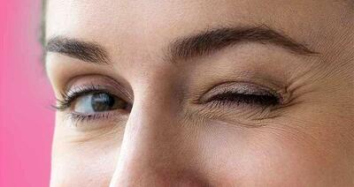 علائم و علت پرش پلک یا تیک عصبی چشم/ راه درمان چیست؟