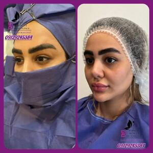 لیفت دائمی ابرو: ابروهاتون دیگه نیاز به آرایش دائم ندارن!
