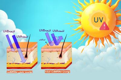 شاخص UV چیست و چرا باید روزانه آن را رصد کنیم؟ | سوختگی ارغوانی