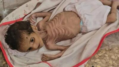 سازمان ملل: گرسنگی در غزه قاتل خاموش است - تسنیم