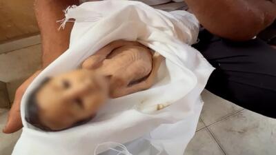 غدیر کوچک غزه قربانی قحطی و گرسنگی شد