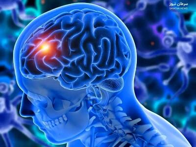 گلیوبلاستوما چیست و چرا تا این حد نگران‌کننده محسوب می‌شود؟