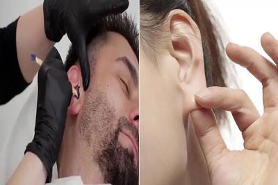از بین بردن موهای رو و داخل گوش؛ هیچ خودتو تو دردسر و زحمت ننداز یه ذره شکر میخوای