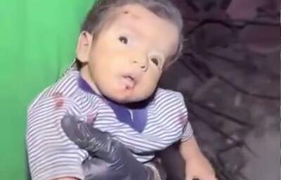 شوک و حیرت در چشمان نوزاد فلسطینیِ نجات‌یافته از زیر آوار خانه ویران‌شده