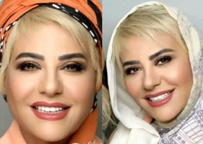 ماجرای کشف حجاب رابعه اسکویی و بازی در شبکه جم