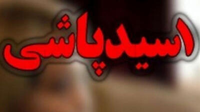 فرار مرد افغانستانی بعد از اسیدپاشی به خواهرش