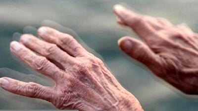 چگونه روند پارکینسون کند می‌شود؟