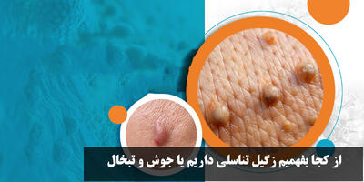 از کجا بفهمیم زگیل تناسلی داریم یا جوش و تبخال در زنان و مردان؟