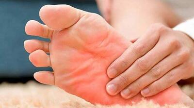 میگنا - داغی کف پا نشانه چیست و چه علتی دارد؟