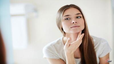 چگونه از جوش زدن بعد از عرق کردن جلوگیری کنیم