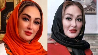 تصویر روز | چهره الهام حمیدی قبل از عمل | گلی شی