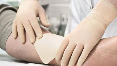 تولید نخستین پانسمان زیستی خشک از پرده آمنیوتیک در ایران