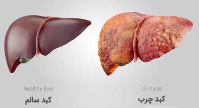 با قاتل کبد‌چرب آشنا شوید | جهان نیوز