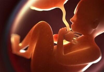 خطر کمبود آهن برای مادر و جنین