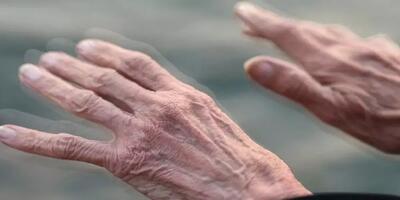 پارکینسون بیماری سالمندان/ شناسایی ۲۵۰ هزار مورد مبتلا به پارکینسون در کشور