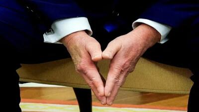 «ترامپ» جلوی دوربین آمد، اما افکار عمومی هنوز می‌گویند او بیمار است؛ چرا؟ / از پیش‌بینی عمر ۲۰۰ ساله تا یک کبودی روی دست که همه چیز را به هم ریخت