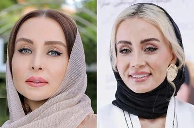 ادعای عجیب حدیث فولادوند: عمل زیبایی نکرده‌ام +فیلم