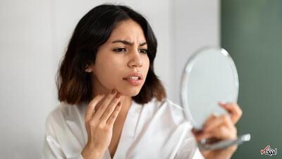 مرطوب‌کننده ژلی یا کرمی؛ کدام برای پوست چرب بهتر است؟