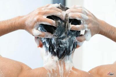 ژل جدید ممکن است به پیشگیری از ریزش مو در طول شیمی‌درمانی کمک کند