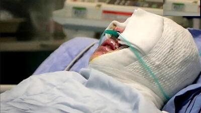 شاکی دریادل از قصاص گذشت / آزادی زن اسیدپاش پس از سال‌ها زندان