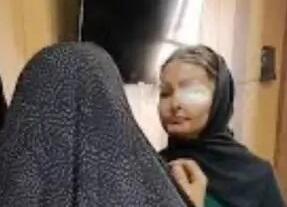 بخشش ضارب اسید پاش پس از ۱۱ سال