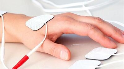 فعالیت 9 هزار فیزیوتراپیست در کشور/ بسیاری از خدمات رایج تحت پوشش بیمه‌ها نیست