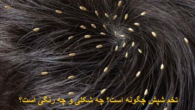 تخم شپش چگونه است؟ چه شکلی و چه رنگی است؟ تا چند روز روی لباس زنده میماند؟