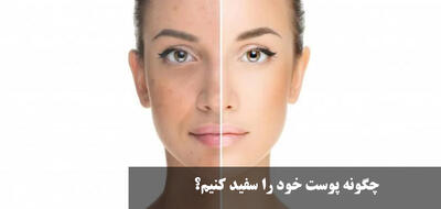چگونه پوست خود را سفید کنیم؟ ماسک خانگی سفید کننده دائمی صورت فوری
