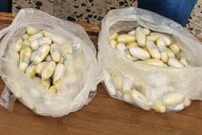 جاساز ۱۲۹ بسته هروئین در معده قاچاقچی