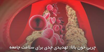 چربی خون بالا؛ تهدیدی جدی برای سلامت جامعه