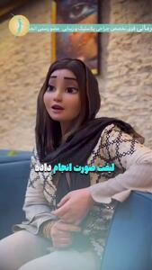لیفت صورت