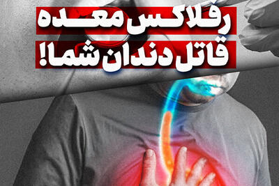 رفلاکس معده قاتل دندان شما!