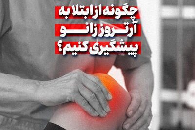چگونه از ابتلا به آرتروز زانو پیشگیری کنیم؟
