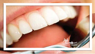 رنگ دندان‌ها درباره سلامت‌تان چه می‌گویند؟