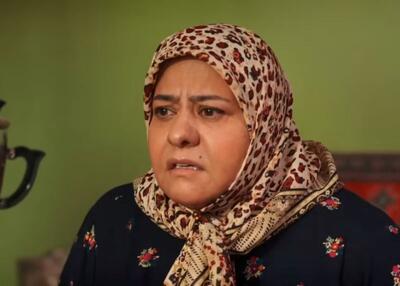 تغییر چهره رابعه اسکویی بعد از عمل زیبایی پربازدید شد+عکس