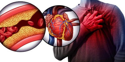 یک روش ساده برای کاهش کلسترول خون
