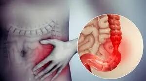 سندرم روده تحریک‌پذیر را جدی بگیرید!