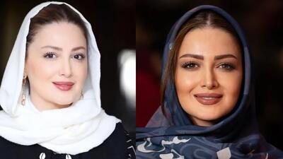 خبر روز | باور می‌کنید شیلا خداداد قبل از عمل بینی این شکلی بوده | گلی شی