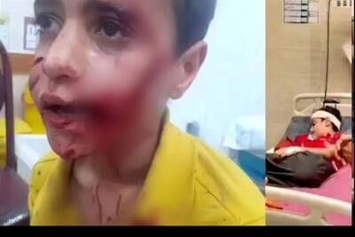 مرگ دلخراش کودک ۱۱ ساله بر اثر حمله سگ‌های ولگرد در مسجدسلیمان