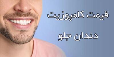 قیمت کامپوزیت دندان جلو