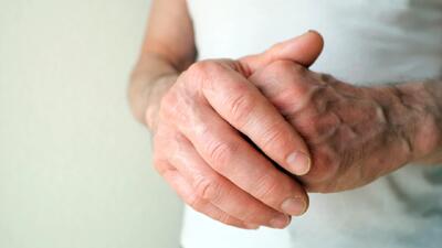 این نشانه می گوید شما در آینده دچار روماتیسم مفصلی می شوید