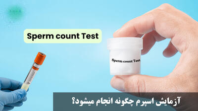 آزمایش اسپرم چگونه انجام میشود؟ بهترین زمان برای آزمایش اسپرم چه وقتی است؟