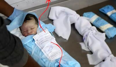 تصاویر؛ مرگ نوزادان غزه به دلیل محاصره و کمبود دارو و غذا