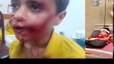 مرگ دلخراش کودک ۱۱ ساله درپی حمله ‌سگ‌های ولگرد