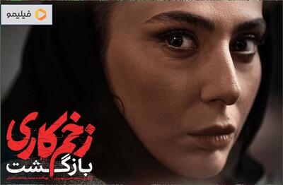 تغییر چهره باورنکردنی و پیرِ سمیرایِ زخم کاری و همسرش